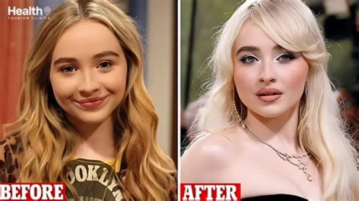 Before And After: Sabrina Carpenter's Transformation Over The Years