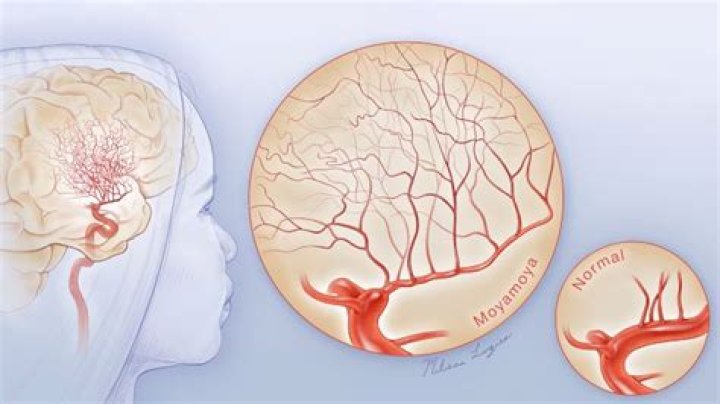 Discover The Allure Of Moya West: Secrets And Insights