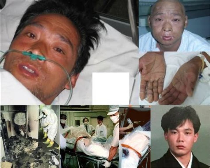 Hisashi Ouchi: A Survivor's Tale After Radiation Exposure