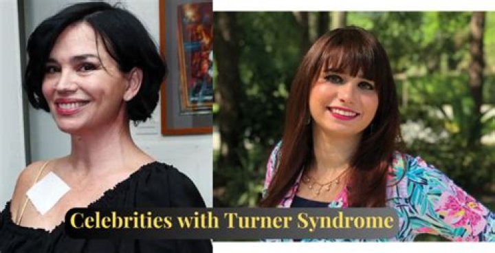 Inspiring Lives: Famous People With Turner Syndrome