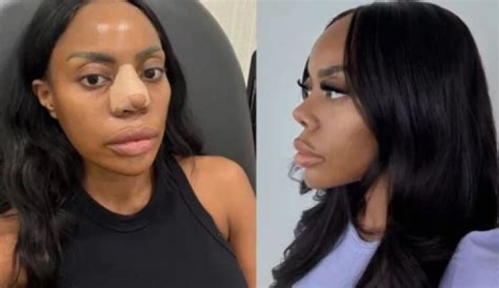 Lance Bass And His Journey Through Cosmetic Surgery: The Nose Job Revelation