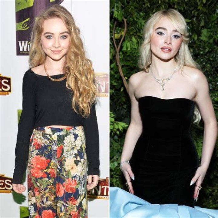 Sabrina Carpenter's Transformation: Before And After Plastic Surgery
