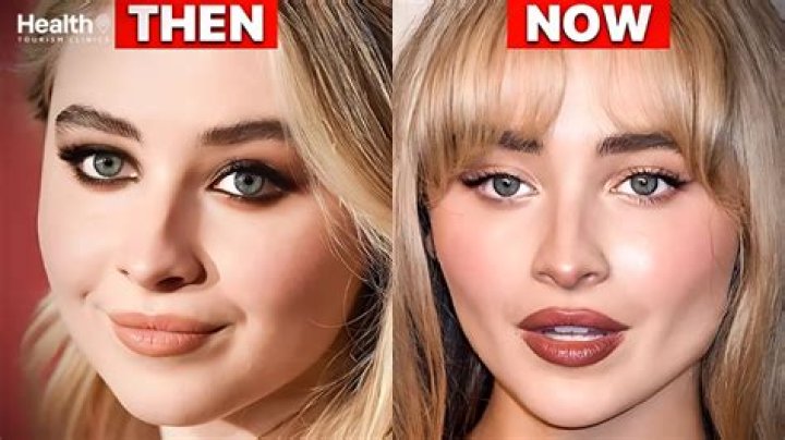 The Ultimate Guide: Did Sabrina Carpenter Undergo Cosmetic Surgery?