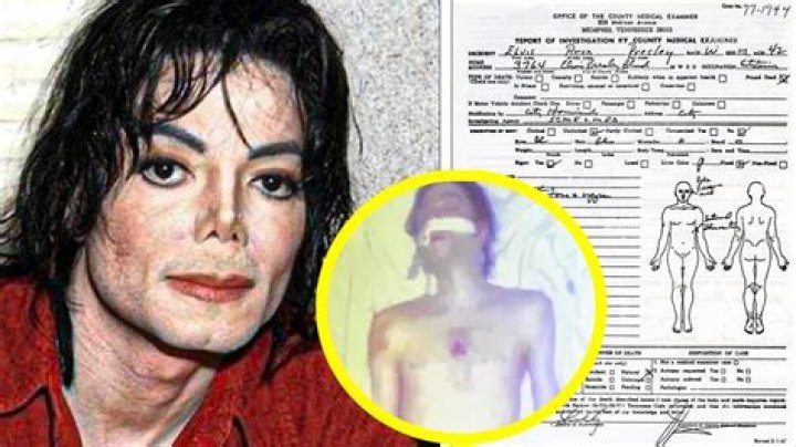 Uncovering The Secrets: Michael Jackson's Autopsy Findings
