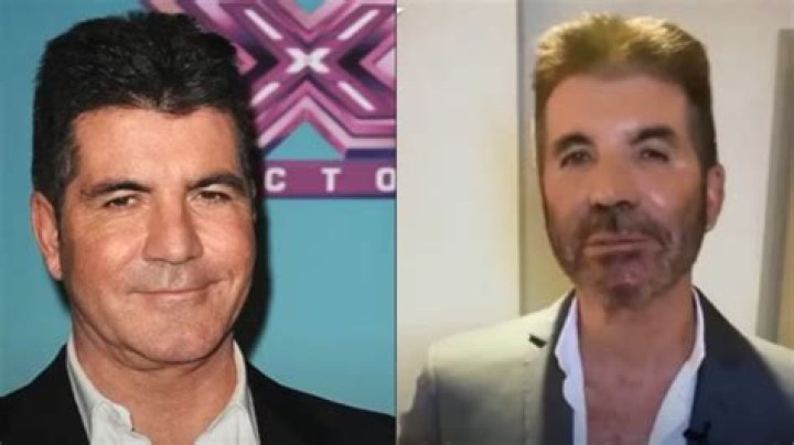 Understanding Simon Cowell's Son Condition: A Deep Dive