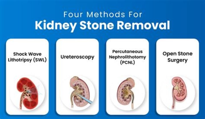 Understanding The Aftermath: Kidney Removal Scarring