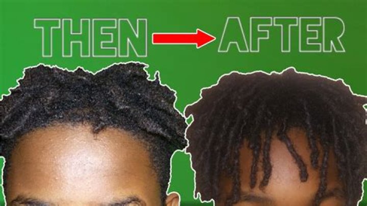 Unlocking The Secret Behind Rapid Dreadlock Growth: Why Do Dreads Grow So Fast?