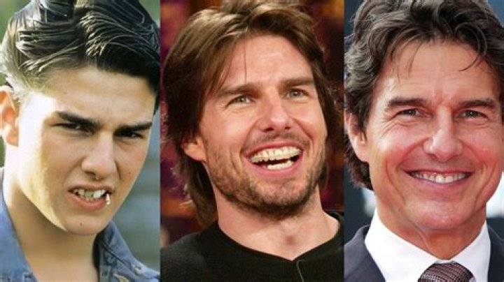Unmasking Tom Cruise's Notorious Teeth: A Candid Examination