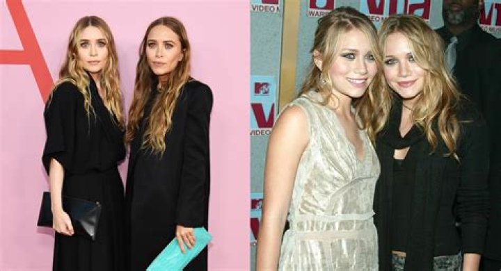 Unveiling The Mystery Of The Olsen Twins And Buccal Fat