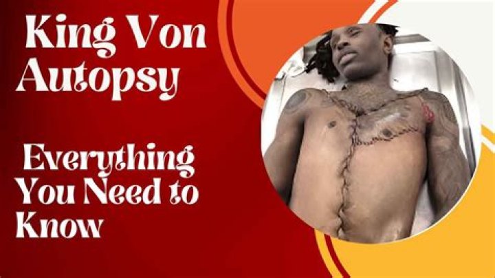 Unveiling The Truth: The King Von Autopsy Picture And Its Impact